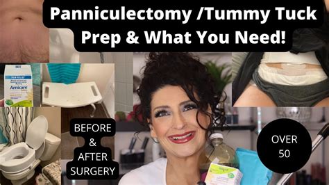 Panniculectomy -Tummy Tuck, What you need know - Before & After, Over 50 #tummytuck, # ...