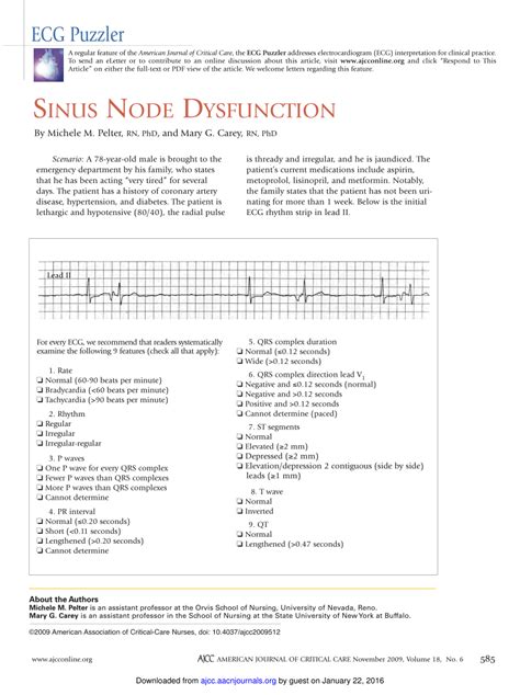 (PDF) Sinus Node Dysfunction