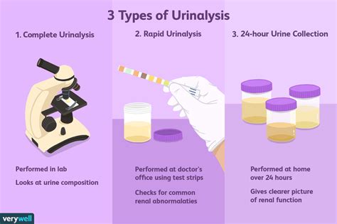 Urinalysis: Uses, Side Effects, Procedure, Results