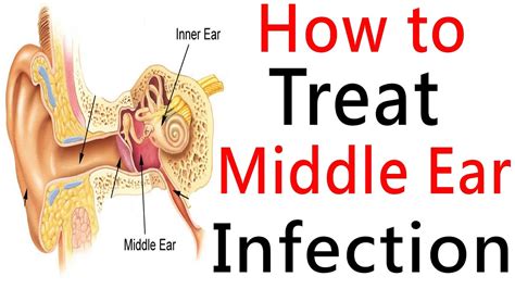 Inner Ear Infection Otoscope