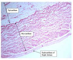 Endocardium Histology