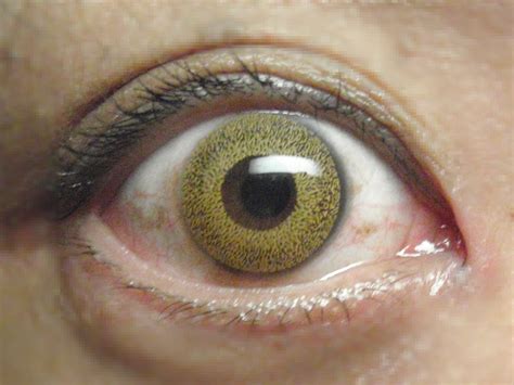 File:Color contact lens eye brown.jpg - 維基百科，自由的百科全書