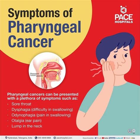 Early Throat Cancer Treatment