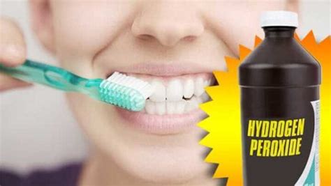 10 Simple Ways To Whiten Teeth Naturally At Home!