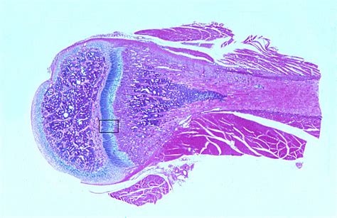 HLS [ Cartilage and Bone and Bone Histogenesis, endochondral ...