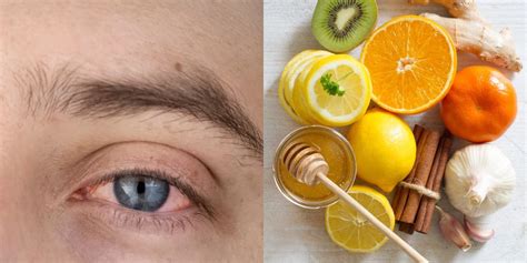 Eye Flu Prevention: Home Remedies That Can Prevent Eye Flu - HerbTib Blog