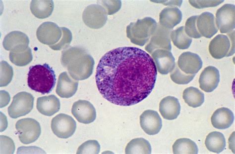 Promyelocyte blood cell,light micrograph – Bild kaufen – 11642813 ...