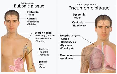 Bubonic Plague Symptoms Buboes