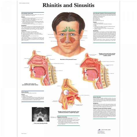 Human Ear Chart - SEM Trainers