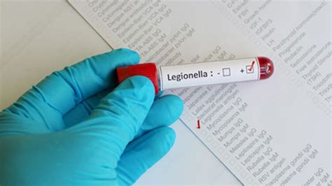 Legionella - Everything you need to know, including how | Phoenix ...