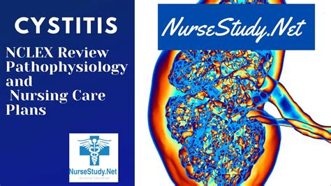 Cystitis Nursing Diagnosis Care Plan - NurseStudy.Net