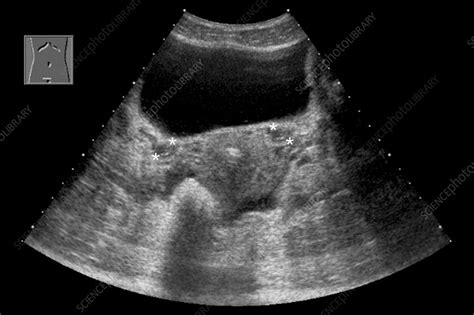 'Uterus and ovaries, ultrasound' - Stock Image - C003/0934 - Science Photo Library