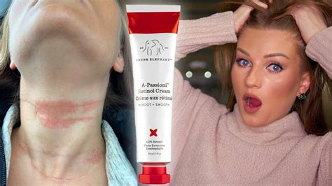 Drunk Elephant A-Passioni Retinol Cream! Review and Skin Reaction - YouTube