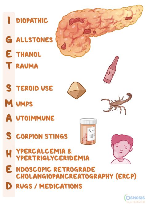 I GET SMASHED: Causes of Pancreatitis Mnemonic | Osmosis