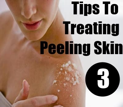 Treating Peeling Skin – Natural Home Remedies Fitness Guide