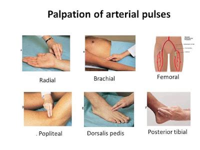 Study Medical Photos: Palpation of Arterial Pulses - Pictures