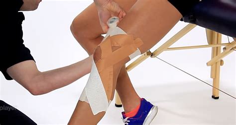 MCL Sprain Knee Taping - How To Tape a Medial Knee Ligaments