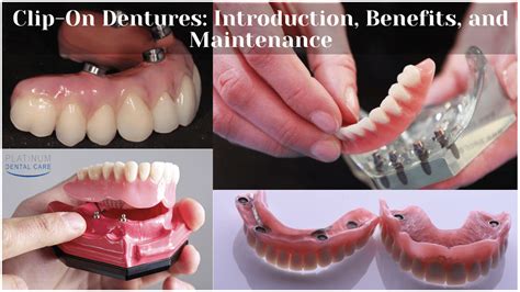 Clip-On Dentures: Introduction, Benefits, And Maintenance