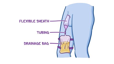 Condom catheters: Clinical skills notes | Osmosis