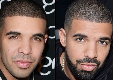 Truth Behind Drake Nose Job Plastic Surgery?