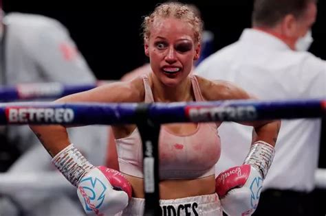 Battered Ebanie Bridges left disfigured with ugly eye injury from her bloody boxing bout - Daily ...