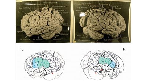 Einstein's brain was definitely not like the others, scientists say