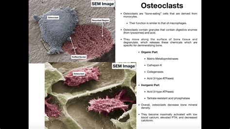 Physiology of the Osteoclast - YouTube