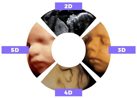 The Difference Between 2D, 3D, 4D, HD and 5D Ultrasound Studio