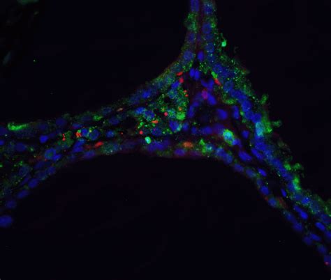 DNase II Antibody - Cat. No. 2059 | ProSci