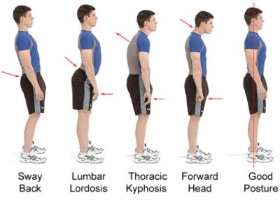 “Form Follows Function” Wolff’s Law & The NST Approach for Treating Pathologies | Brandon Pain ...