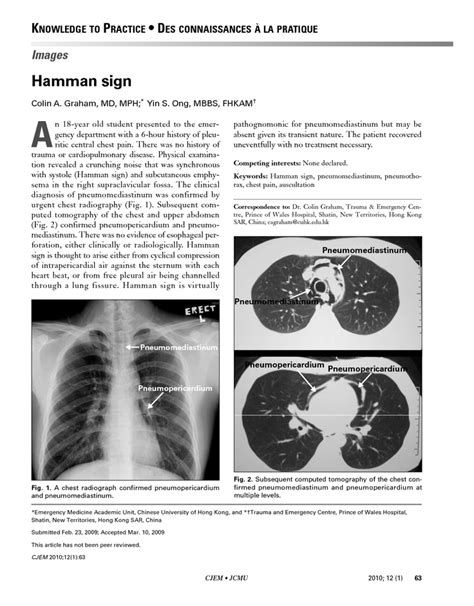 Hamman's sign in pneumomediastinum: systolic crepitations! | Pa life, Signs, Knowledge