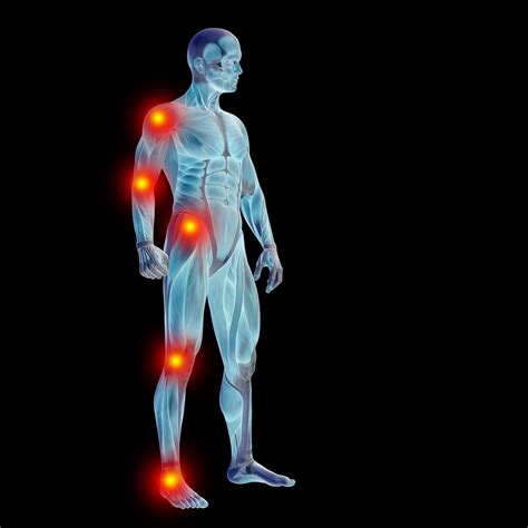 Sports and Musculoskeletal Injury | Physiot