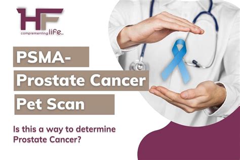 PSMA PET Scan- Is This A Way To Determine Prostate Cancer? - HealthFinder