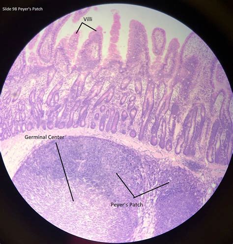 Peyer's Patch Histology.