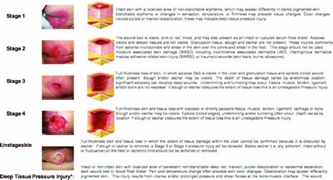 Staging Pressure Ulcers Nursing