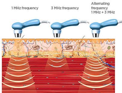 Ultrasound therapy dangers | Science online