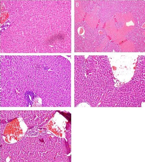 Histological picture of liver parenchyma of normal group (A ...