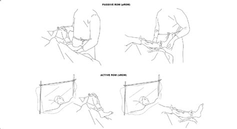 pROM: Passive flexion-extension movement performed by the surgeon (A).... | Download Scientific ...