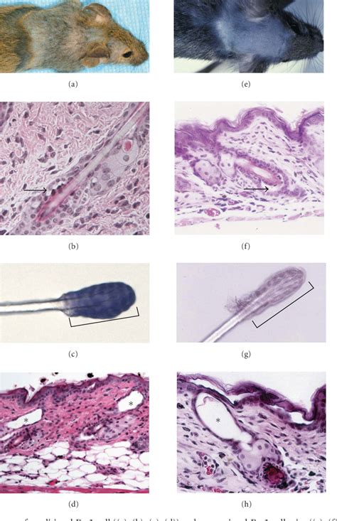 Figure 3 from Mouse Models for Blistering Skin Disorders | Semantic Scholar