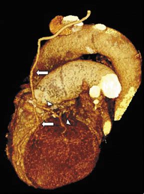 Ultrasound of the acute scrotum • APPLIED RADIOLOGY