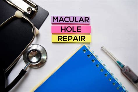 An Introduction to Macular Hole Surgical Procedure