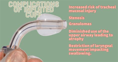 To Inflate or Deflate? Tracheostomy Tube Cuff – CriticalCareNow