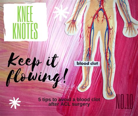 What Are Signs Of A Blood Clot After Knee Replacement Surgery at David Lord blog