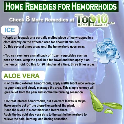 Home Remedies for Hemorrhoids (Piles) | Top 10 Home Remedies