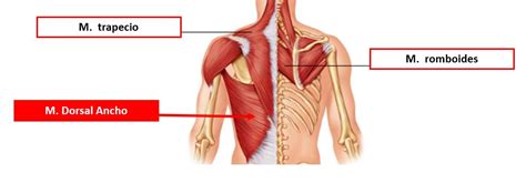 Infiltración del músculo dorsal ancho | Dolopedia