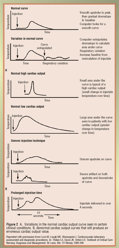 [PDF] Measuring cardiac output: intermittent bolus thermodilution ...