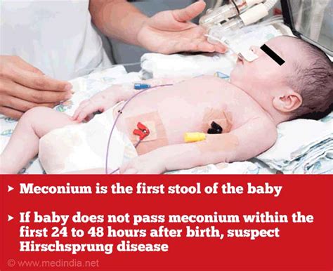 Hirschsprung Disease | Congenital Megacolon - Causes, Symptoms, Diagnosis, Treatment & Prognosis