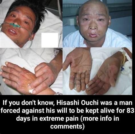 If you don't know, Hisashi Ouchi was a man forced against his will to ...