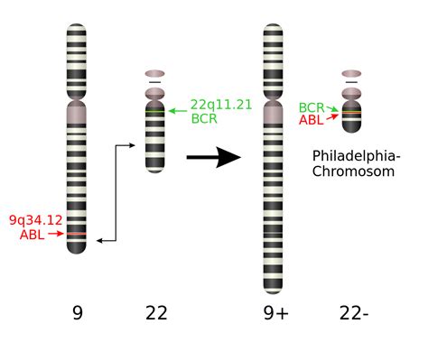 Philadelphia chromosome - WikiLectures