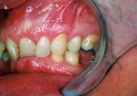 Orthodontic surgery, radiological examination, and planning